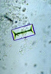 İdrarda Bakteri Belirtileri ve Tedavisi